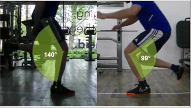 Figuur 2. Landing van het aangedane been (rechts) t.o.v. het niet-aangedane been (links). De gesprongen afstanden waren hierbij vergelijkbaar. Figuur 2. Landing van het aangedane been (rechts) t.o.v. het niet-aangedane been (links). De gesprongen afstanden waren hierbij vergelijkbaar.