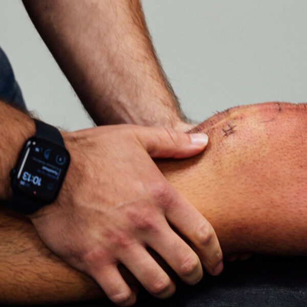 knie test acl voorste kruisband litteken knie test acl voorste kruisband litteken
