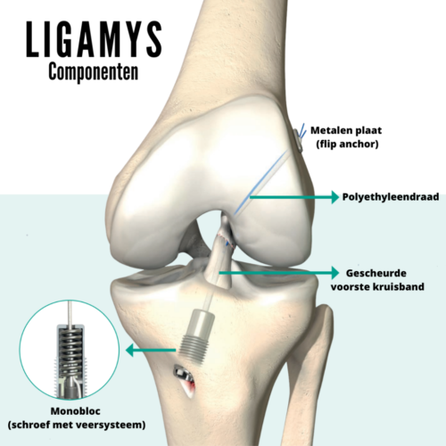 Ligamys ligamys