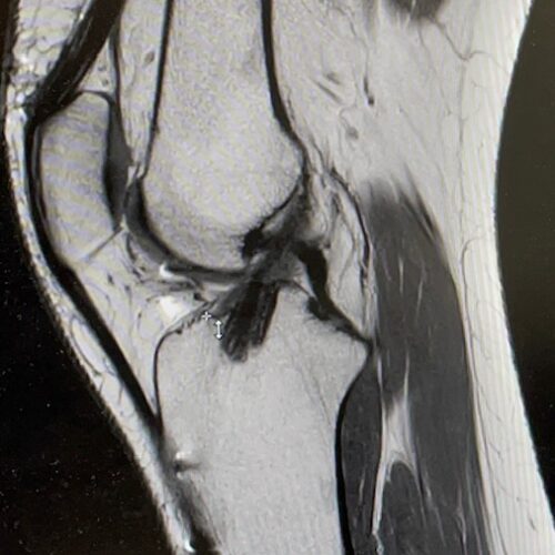 mri vkb mri vkb