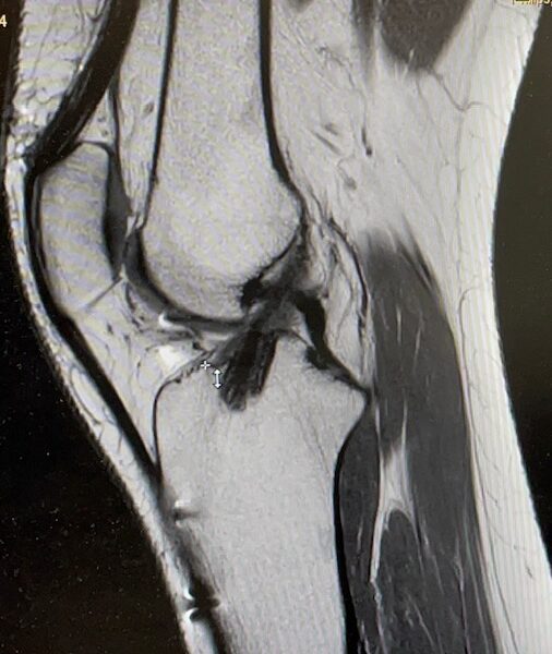 mri vkb mri vkb