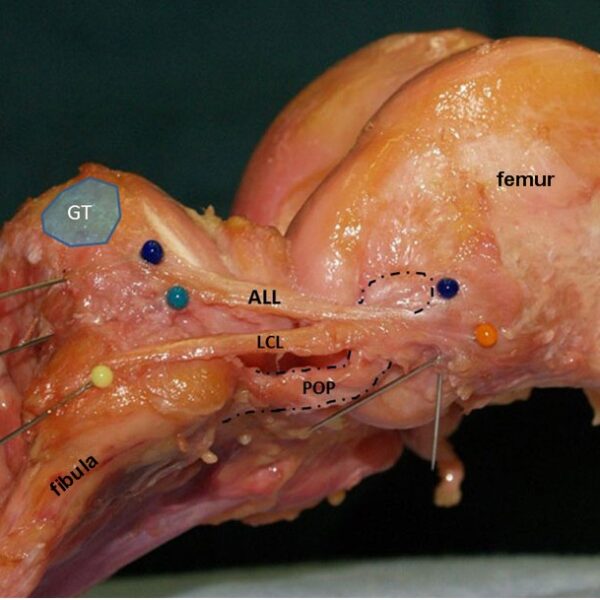 ALL operatie techniek vkb